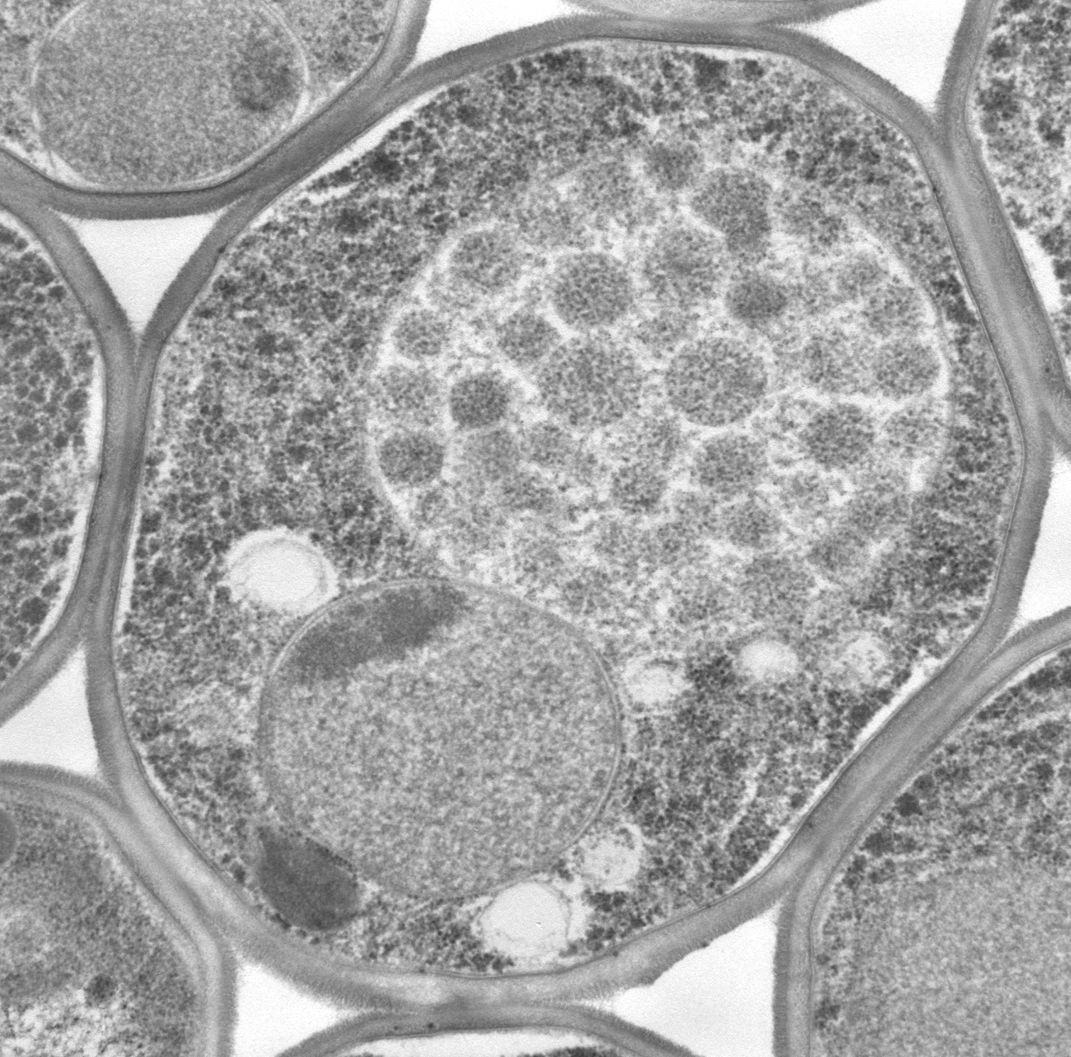 酵母のオートファジーを捉えた像。液胞（中央）のなかに、たくさんのオートファジックボディ（オートファジーによって作られた膜構造）が観察できる。私はこのオートファジックボディを生化学的手法を駆使して精製することに成功しています。