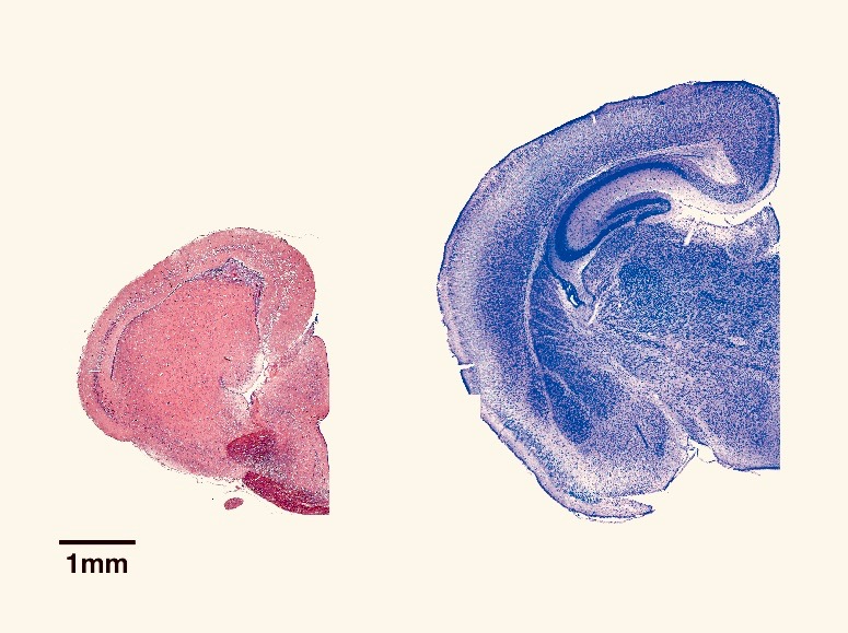 爬虫類（スッポン：左）と哺乳類（マウス：右）の大脳半球の切片です。哺乳類では大脳皮質と呼ばれる部分が大きく発達し、脳の大部分を覆い隠しています。