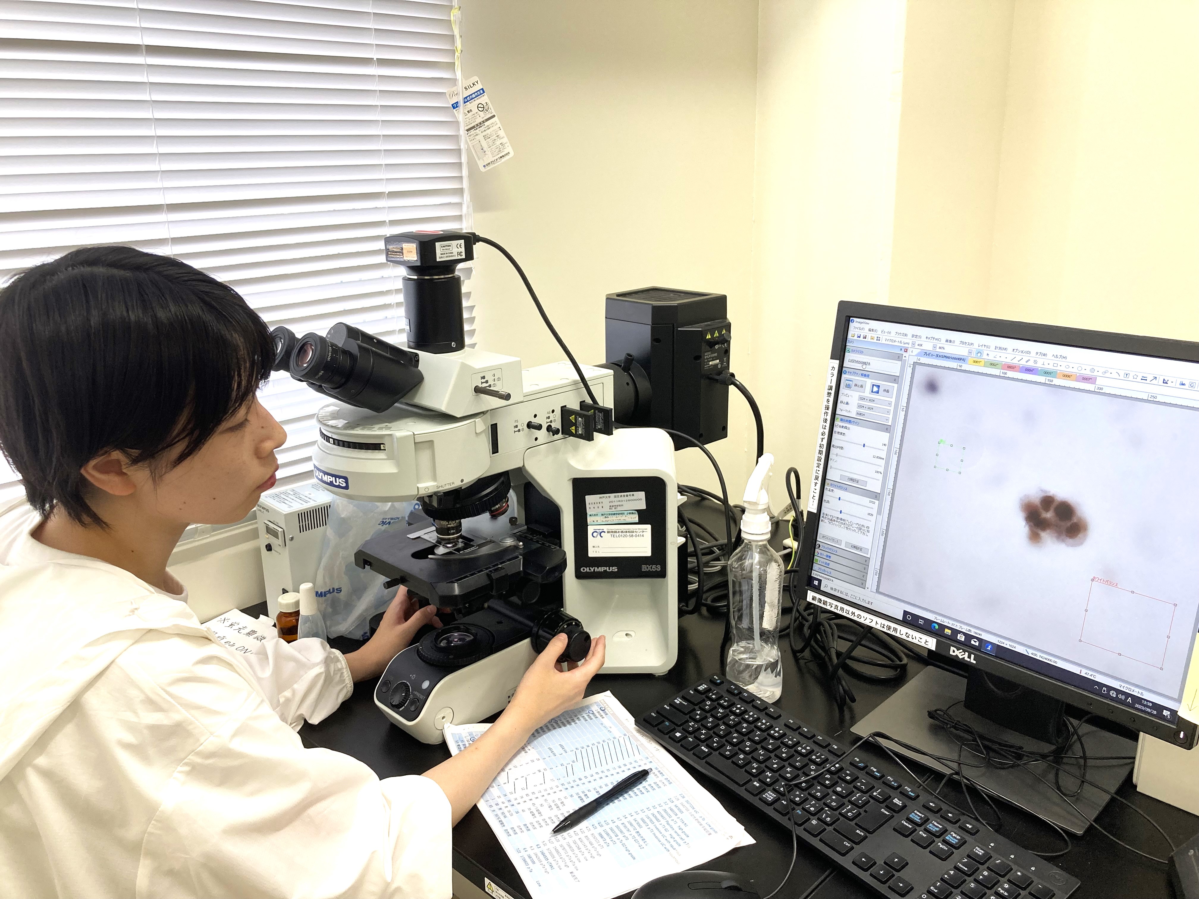 特殊な染色（免疫細胞化学）を行った尿中の癌細胞の顕微鏡写真を撮っています。