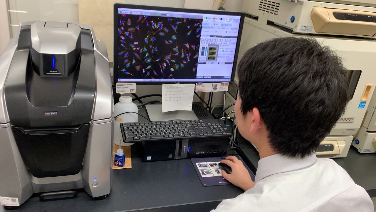 近畿大学薬学部の杉浦研究室で、ヒトの細胞を用いてRNA顆粒を蛍光顕微鏡で観察しています。