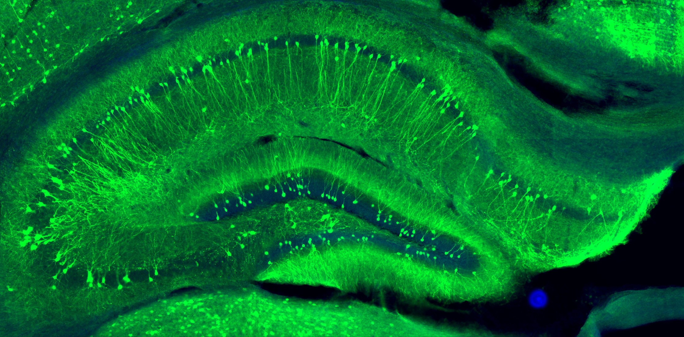 脳神経細胞に遺伝子を入れることで、細胞が緑色に光るように細工してあります。この写真に写っているのは、記憶に大事な海馬と呼ばれる脳領域です。