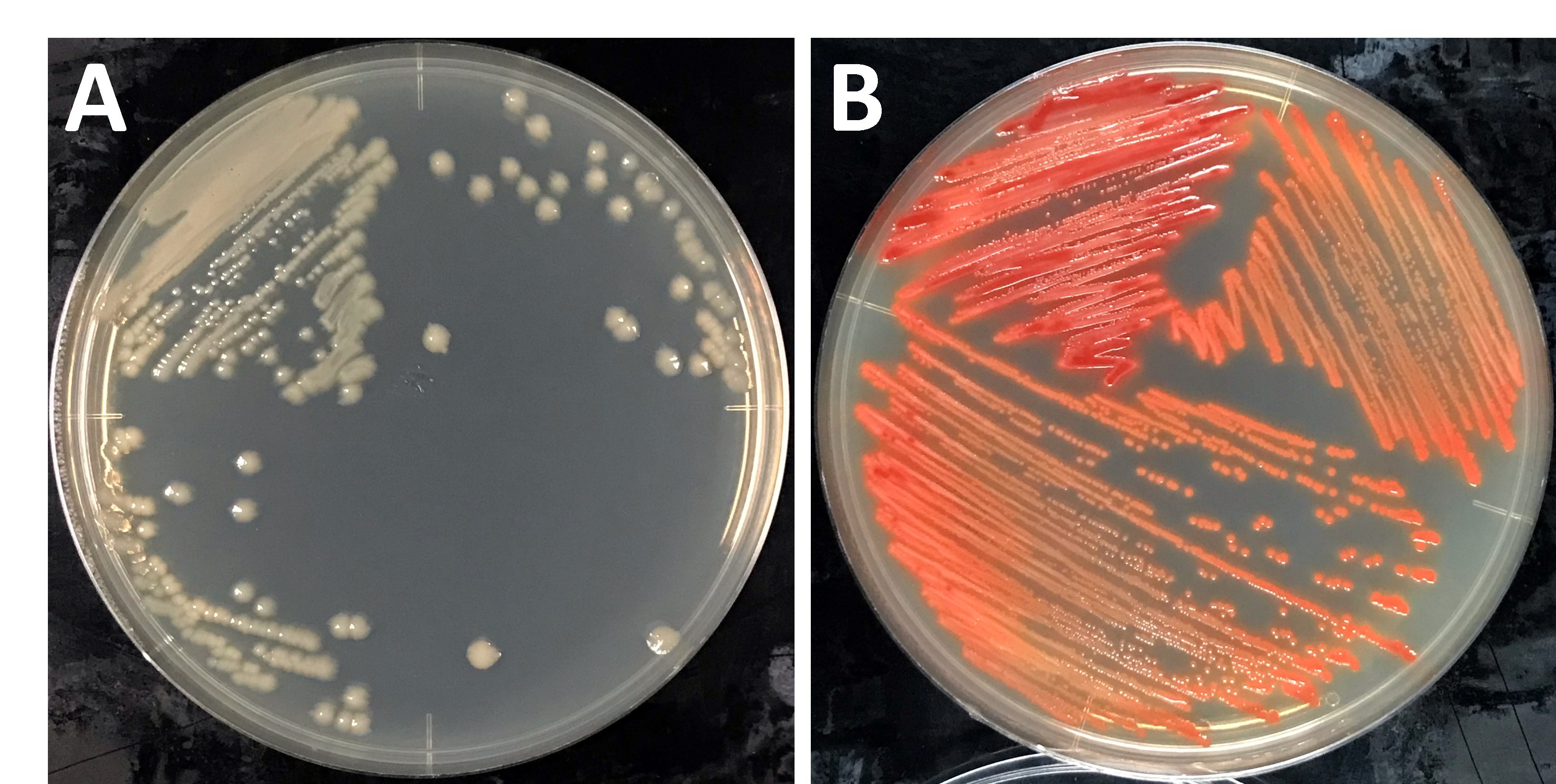 セレン代謝細菌RP3株の寒天培地上での培養の様子。セレンを含まない培地上(A)とセレンを含む培地上(B)での様子を比較すると、セレンを含む培地(B)では、RP3株がセレンを代謝することにより、赤色の単体セレンが生成していることがわかります。