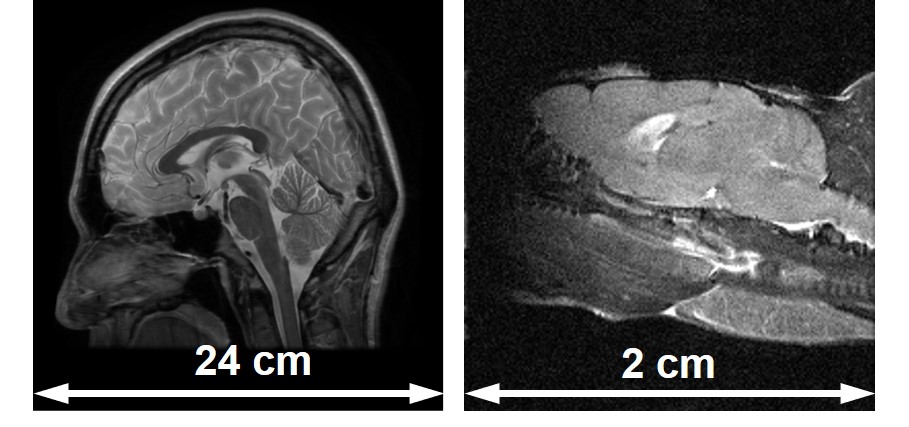 MRIで撮像した私の脳とネズミの脳