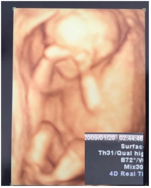 超音波を用いた長男の可視化結果。長男がお母さんのお腹にいた頃に、超音波非破壊検査で長男を映像化した貴重な写真です。もちろん病院でやっていただいたものですが、どんな構造・材料に対しても、同じように構造物内部の傷をはっきりと確認できたら有用です。