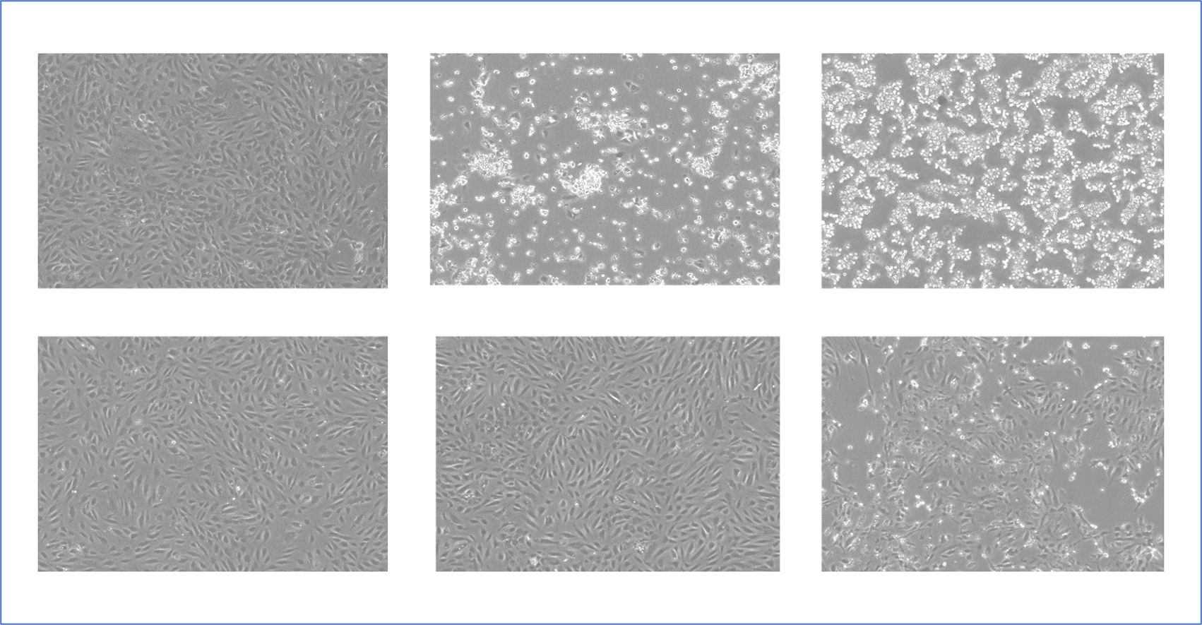 細胞を様々な条件下で培養し、細胞の変化を顕微鏡で観察します。丸くてキラキラしている細胞は障害を受けています。