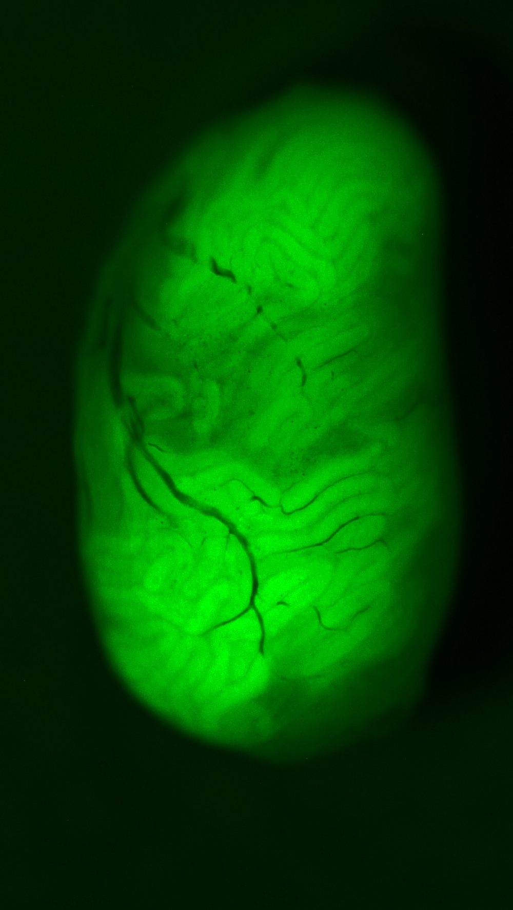 緑色蛍光タンパク質を発現する精子幹細胞を移植されたマウス精巣。移植された細胞の90%は血液精巣関門に弾かれて生着しないため、この移植実験は超超大量の精子幹細胞を濃縮して移植している。『ひらけゴマ！』シグナルで関門をひらけば、少ない幹細胞で精子形成の再生ができるはず。