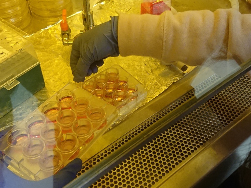 人工皮膚を操作している様子