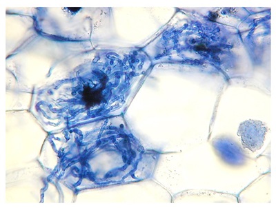 ランの菌根構造の様子。青く染色された糸状のものが菌根菌の菌糸。菌根菌はランの細胞の中まで侵入し、塊状に分枝した構造（ペロトンといいます）を形成します。ペロトンは形成と分解と繰り返し、分解されたペロトン由来の養分はランに吸収され、発芽の際に養分として利用されます。