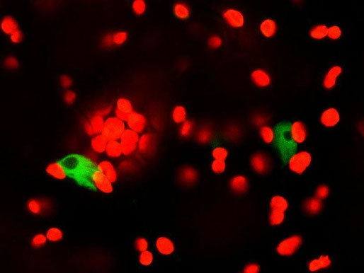 共焦点レーザー顕微鏡によるシロイヌナズナの細胞観察。赤色は葉緑体を、緑色は緑色蛍光タンパク質の蛍光を示しています。核に局在するタンパク質に緑色蛍光タンパク質を融合しているので、核が緑色蛍光を発しています。