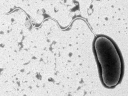 当研究室で撮影したビブリオ・バルニフィカスの電子顕微鏡写真です。ビブリオ・バルニフィカスは、菌体の一端にべん毛と呼ばれる鞭のような構造物を持っています。これを高速で回転させることにより推進力を生み出し、感染者体内を素早く移動して、感染を拡大します。